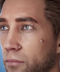 ๐ป๐๐๐บ๐๐๐๐ยฎ 2-in-1 Microneedle & Hydrocolloid Patch