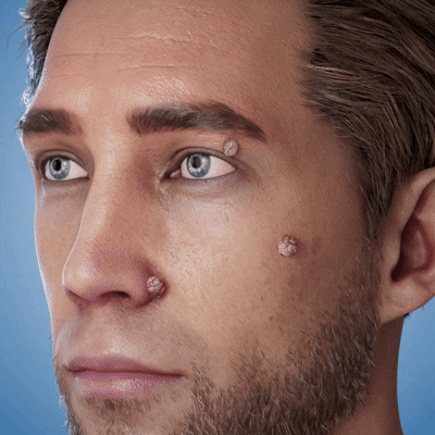 ๐ป๐๐๐บ๐๐๐๐ยฎ 2-in-1 Microneedle & Hydrocolloid Patch
