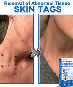 ๐ป๐๐๐บ๐๐๐๐ยฎ 2-in-1 Microneedle & Hydrocolloid Patch