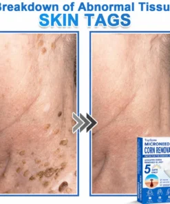 ๐ป๐๐๐บ๐๐๐๐ยฎ 2-in-1 Microneedle & Hydrocolloid Patch