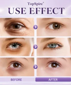 TopSpire 60 Second Effects Tinted Firming Gel - Under Eye Cream For Puffiness And Bags Under Eyes