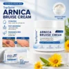 TopSpire® Arnica Bruise Cream