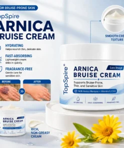 TopSpire® Arnica Bruise Cream