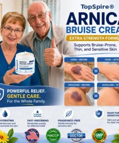 TopSpire® Arnica Bruise Cream