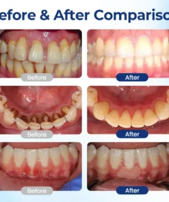 TopSpire® BeeTakt Oral Repair Solution