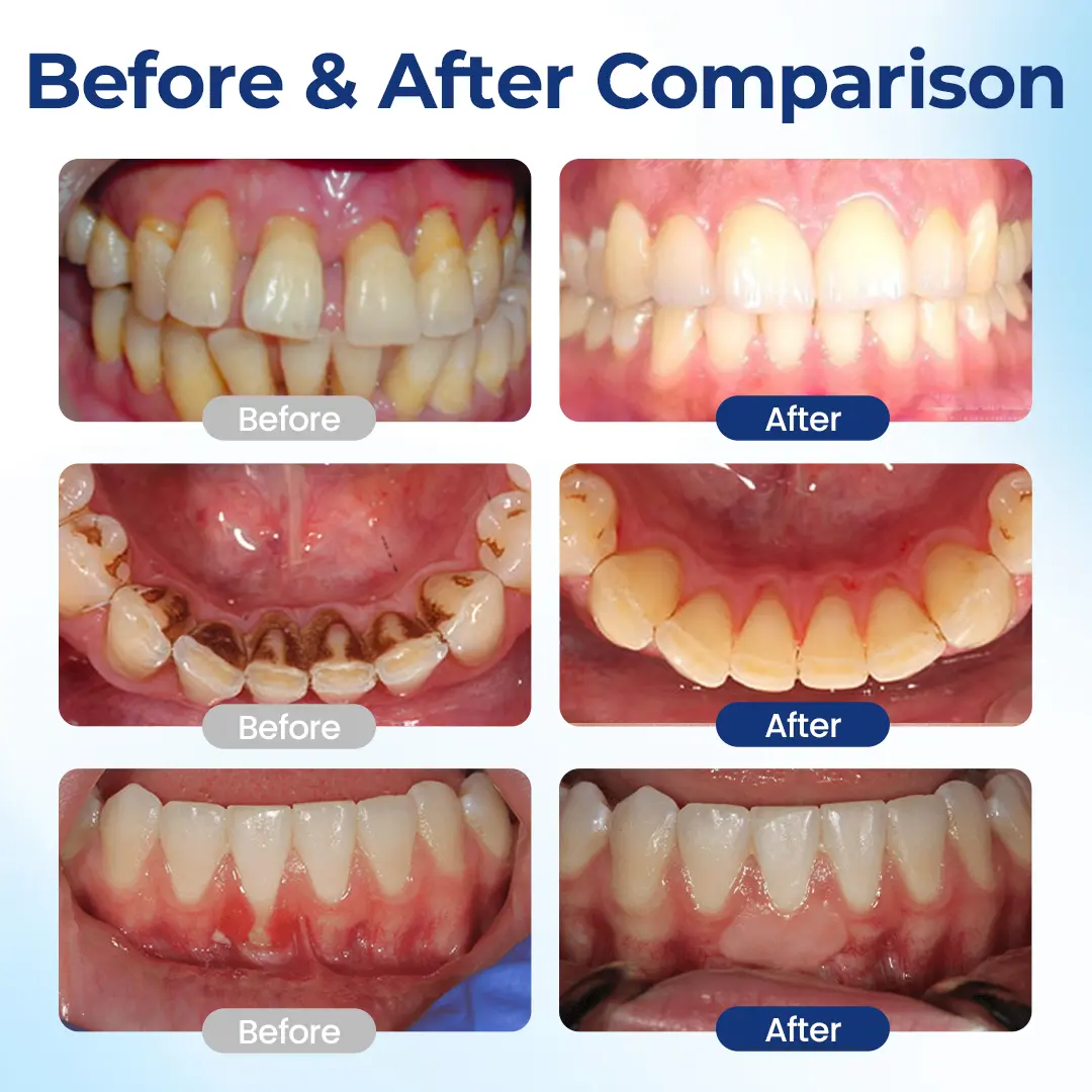 TopSpire® BeeTakt Oral Repair Solution