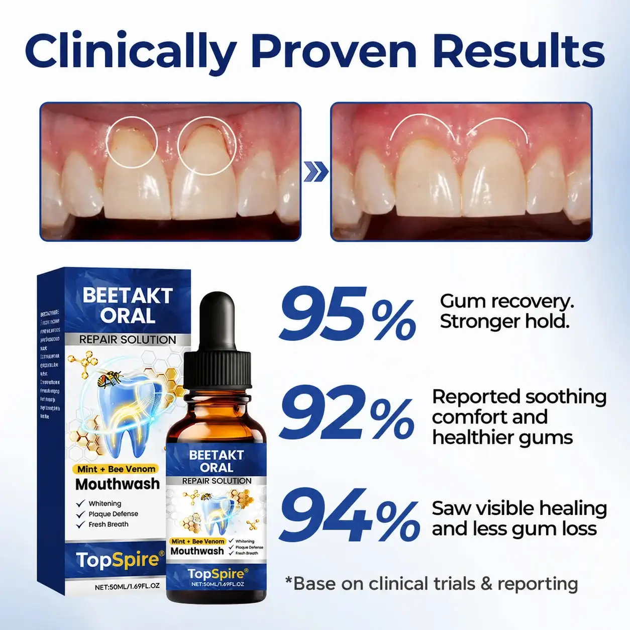 TopSpire® BeeTakt Oral Repair Solution
