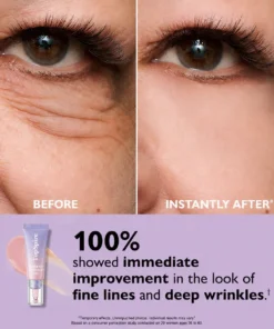 TopSpire Eye Bag Instant Eraser, Tightens, Firms, & Blurs Wrinkles