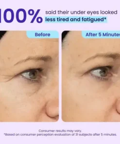 TopSpire Eye Bag Instant Eraser, Tightens, Firms, & Blurs Wrinkles