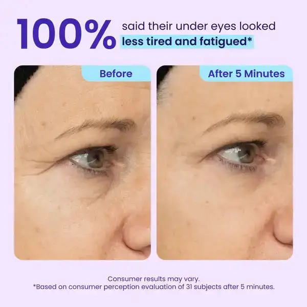TopSpire Eye Bag Instant Eraser, Tightens, Firms, & Blurs Wrinkles