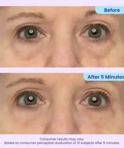 TopSpire Eye Bag Instant Eraser, Tightens, Firms, & Blurs Wrinkles