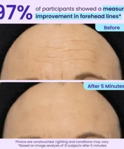 TopSpire Eye Bag Instant Eraser, Tightens, Firms, & Blurs Wrinkles