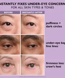 TopSpire Eye Bag Instant Eraser, Tightens, Firms, & Blurs Wrinkles