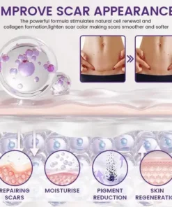TopSpire® ReGenScar Stem Cell Scar Gel
