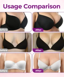 TopSpire® Targeted Breast Enhancement Advanced Nano Microneedle Patch