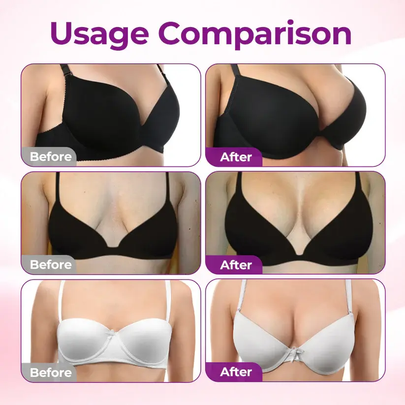 TopSpire® Targeted Breast Enhancement Advanced Nano Microneedle Patch