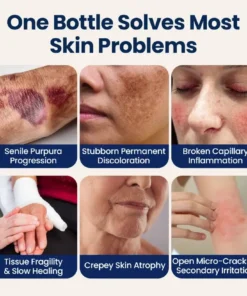 TOPSPIRE® ResiliVeil Bruise Appearance Barrier Care Cream