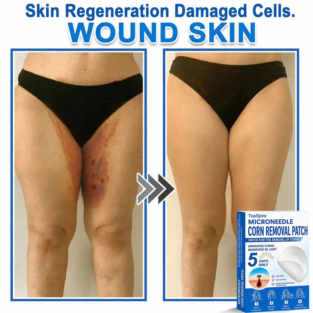 TopSpire® 7-Day Skin Tag & Blemish Remover