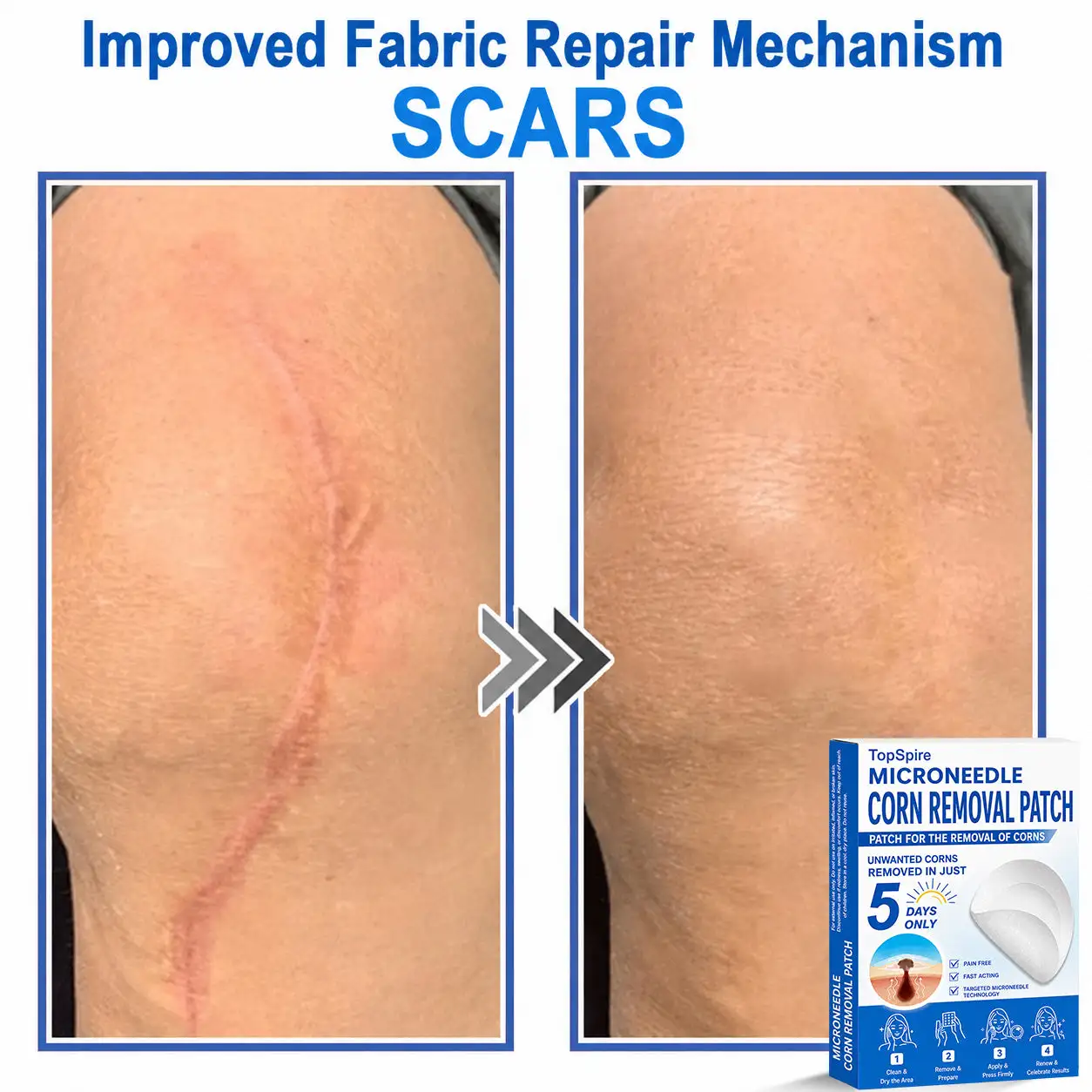 TopSpire® 7-Day Skin Tag & Blemish Remover