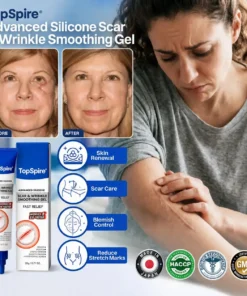 TopSpire Advanced Silicone Scar & Wrinkle Smoothing Gel
