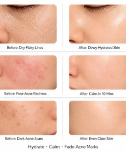 TopSpire® Barrier Repair Cream