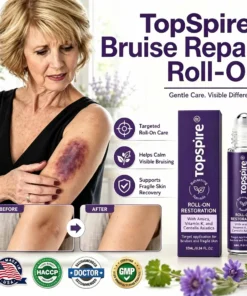 TopSpire® Bruise Repair Roll-On