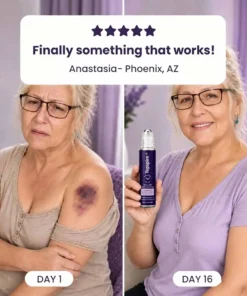 TopSpire® Bruise Repair Roll-On