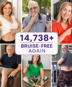 TopSpire® Bruise Repair Roll-On