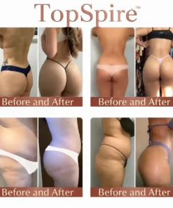 TopSpire™ CurveSculpt Micro-Patch