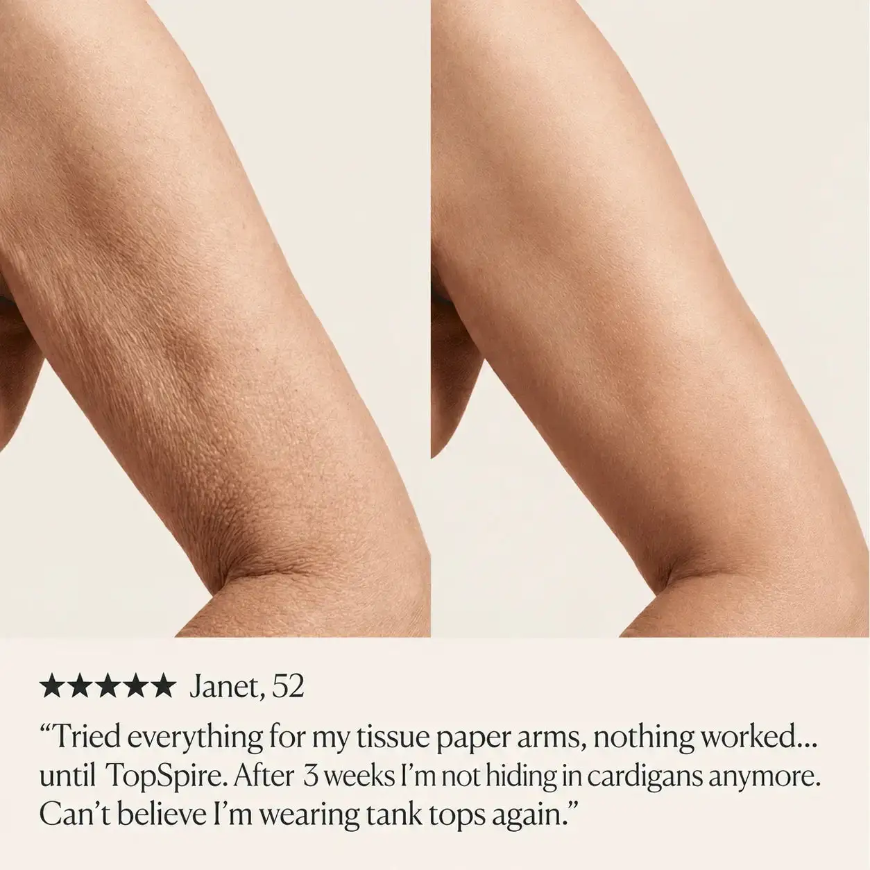 TopSpire Deep Firming Body Cream