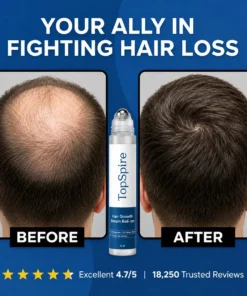 TopSpire Hair Growth Roll on Serum