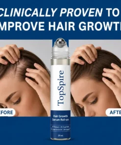 TopSpire Hair Growth Roll on Serum
