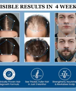 TopSpire Hair Growth Roll on Serum