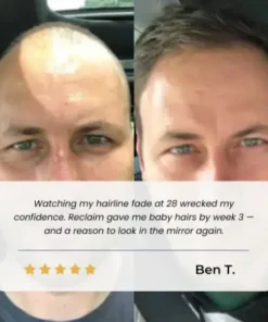 TopSpire Hair Growth Roll on Serum