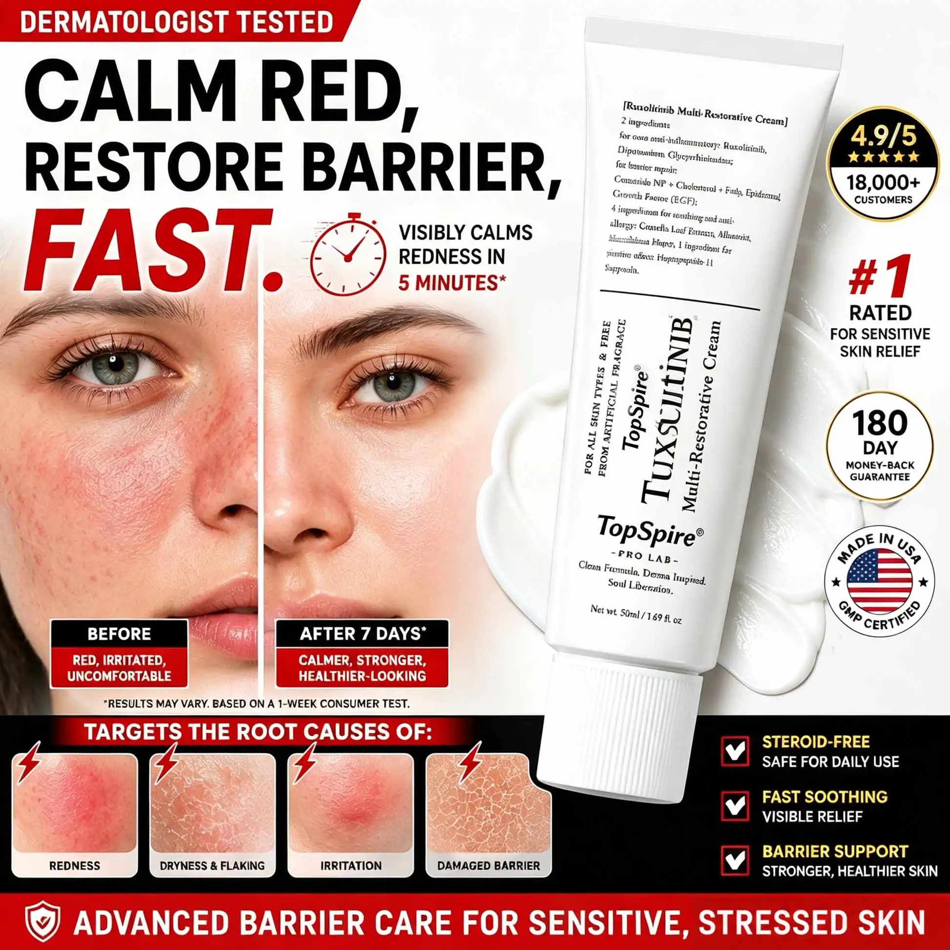TopSpire® JAK-Smart Repair Cream