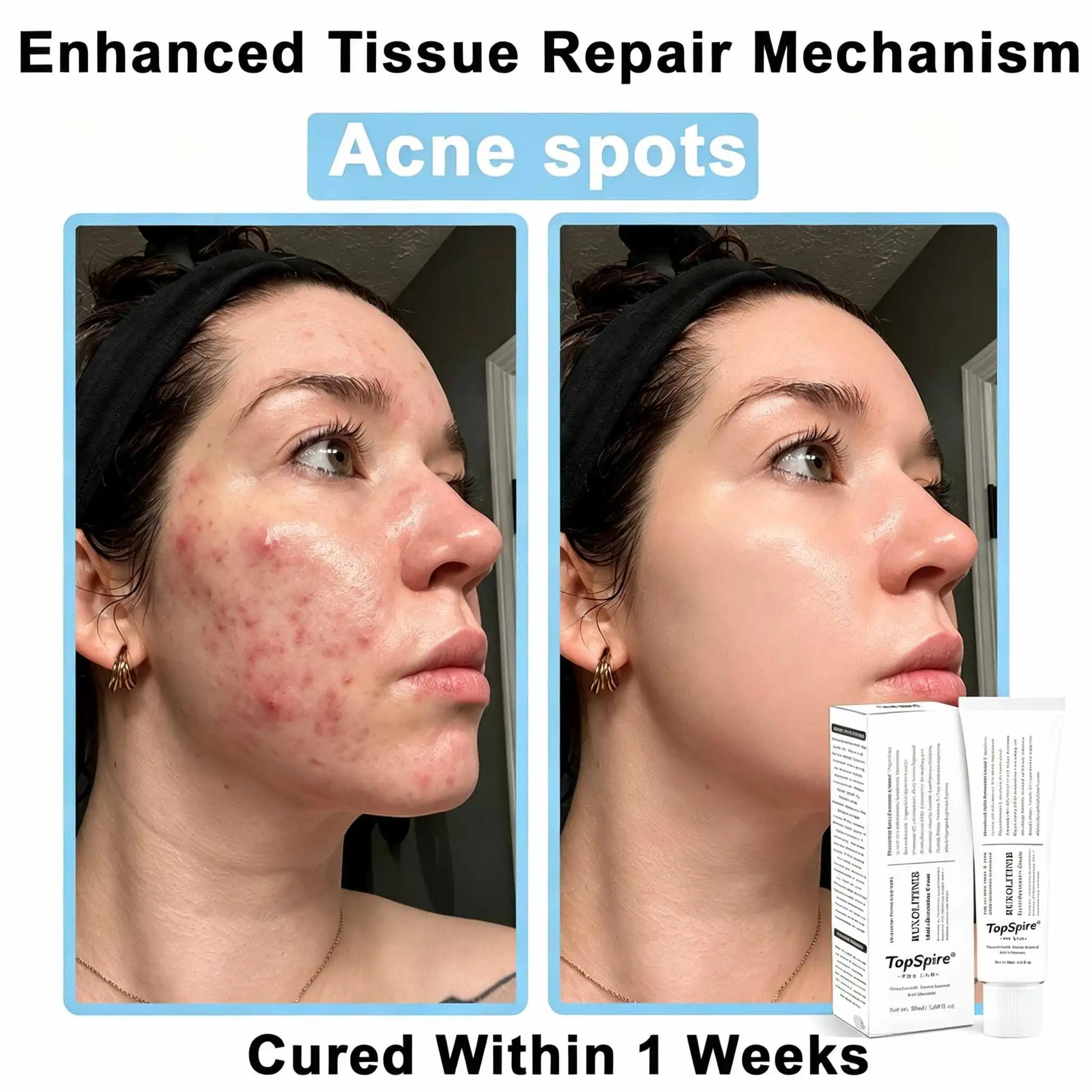 TopSpire® JAK-Smart Repair Cream