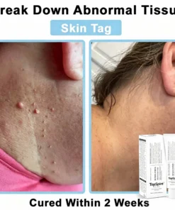 TopSpire® JAK-Smart Repair Cream