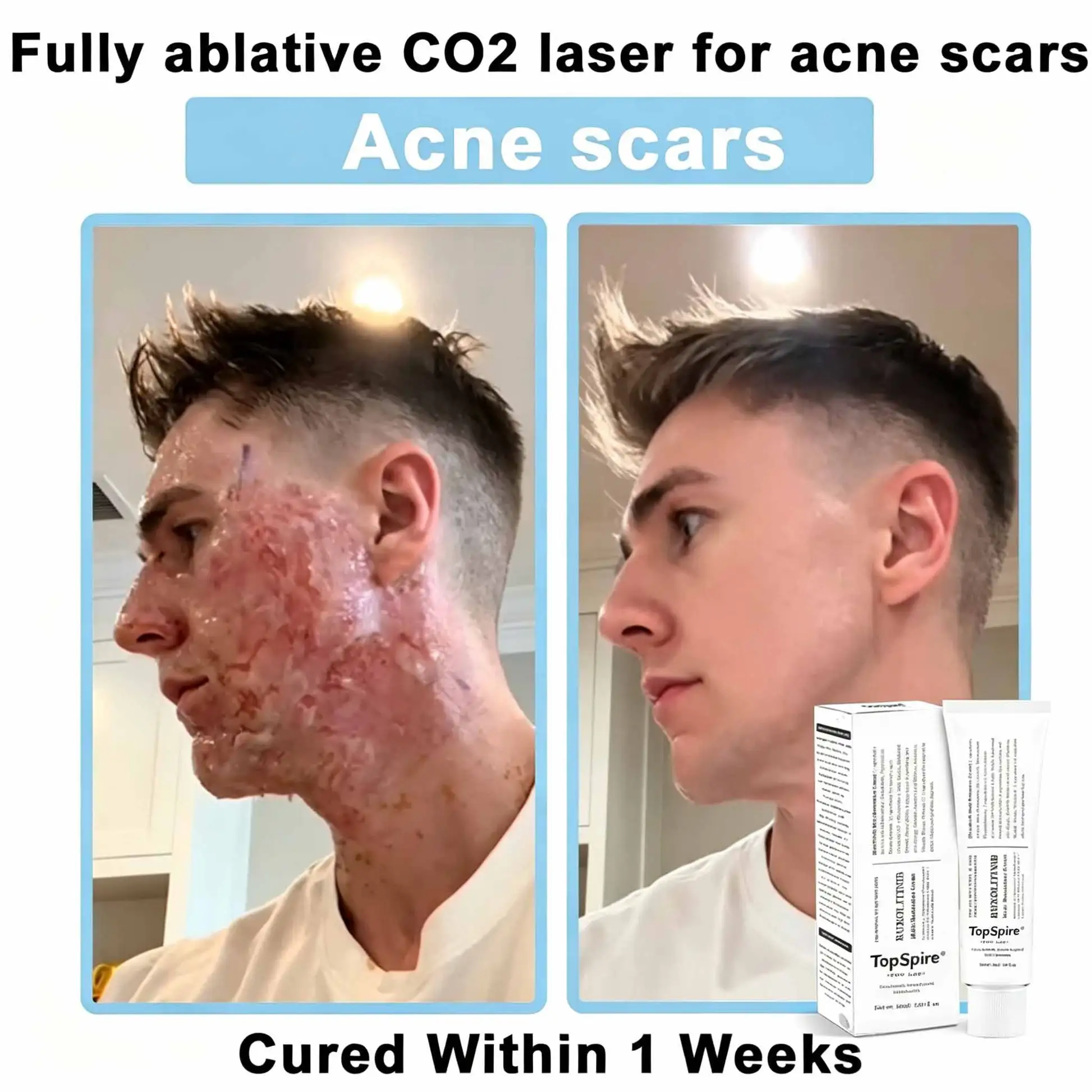 TopSpire® JAK-Smart Repair Cream