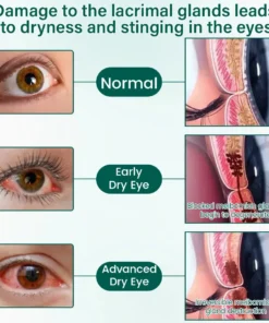 TopSpire™ OptiClear Nano Eye Roller Serum