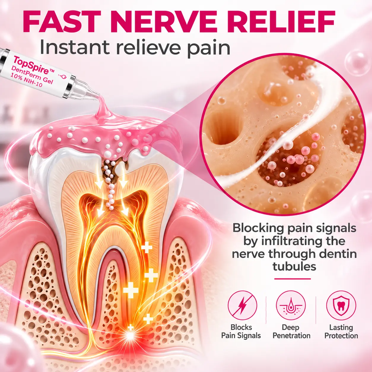 TopSpire™ DenPerm Cavity-Repair Natural Enamel Filling Gel