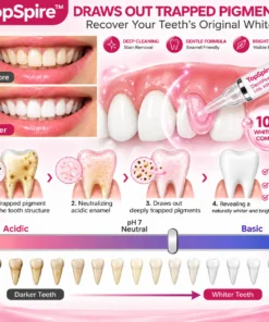 TopSpire™ DenPerm Cavity-Repair Natural Enamel Filling Gel