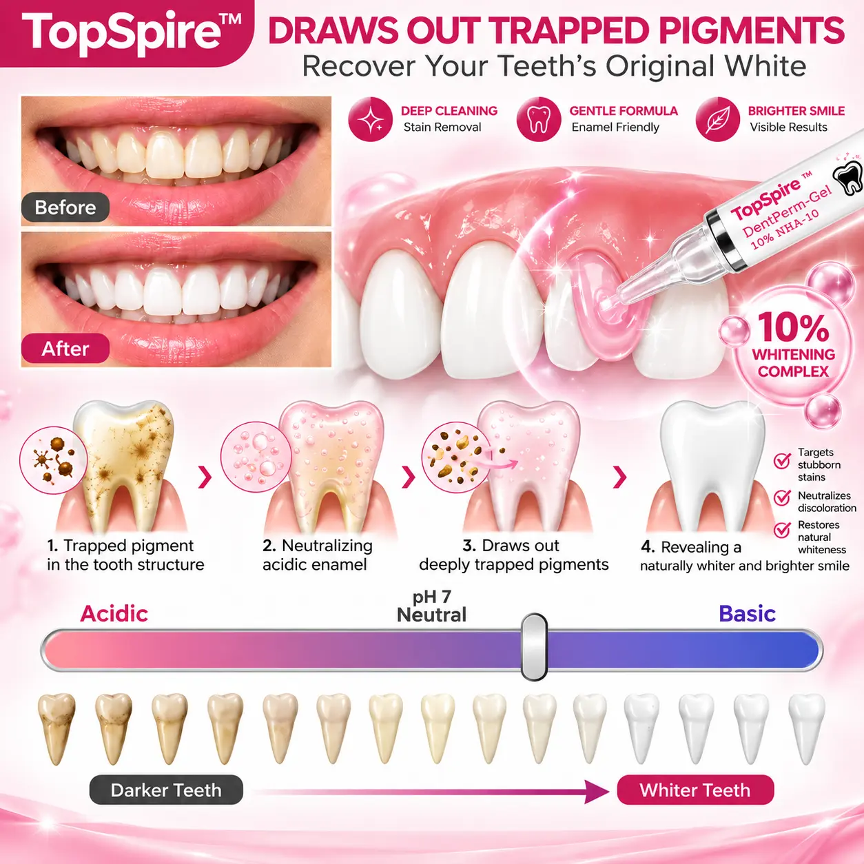 TopSpire™ DenPerm Cavity-Repair Natural Enamel Filling Gel