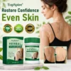 TopSpire® Herbal Vitiligo Cream