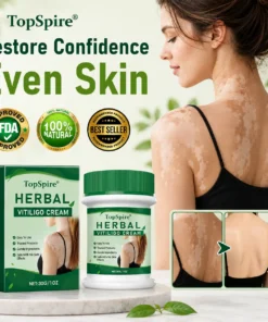 TopSpire® Herbal Vitiligo Cream