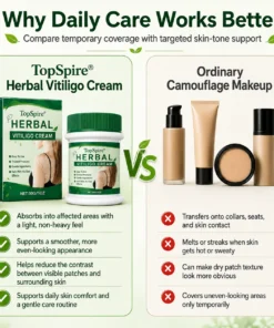 TopSpire® Herbal Vitiligo Cream