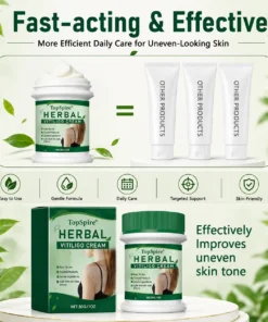 TopSpire® Herbal Vitiligo Cream