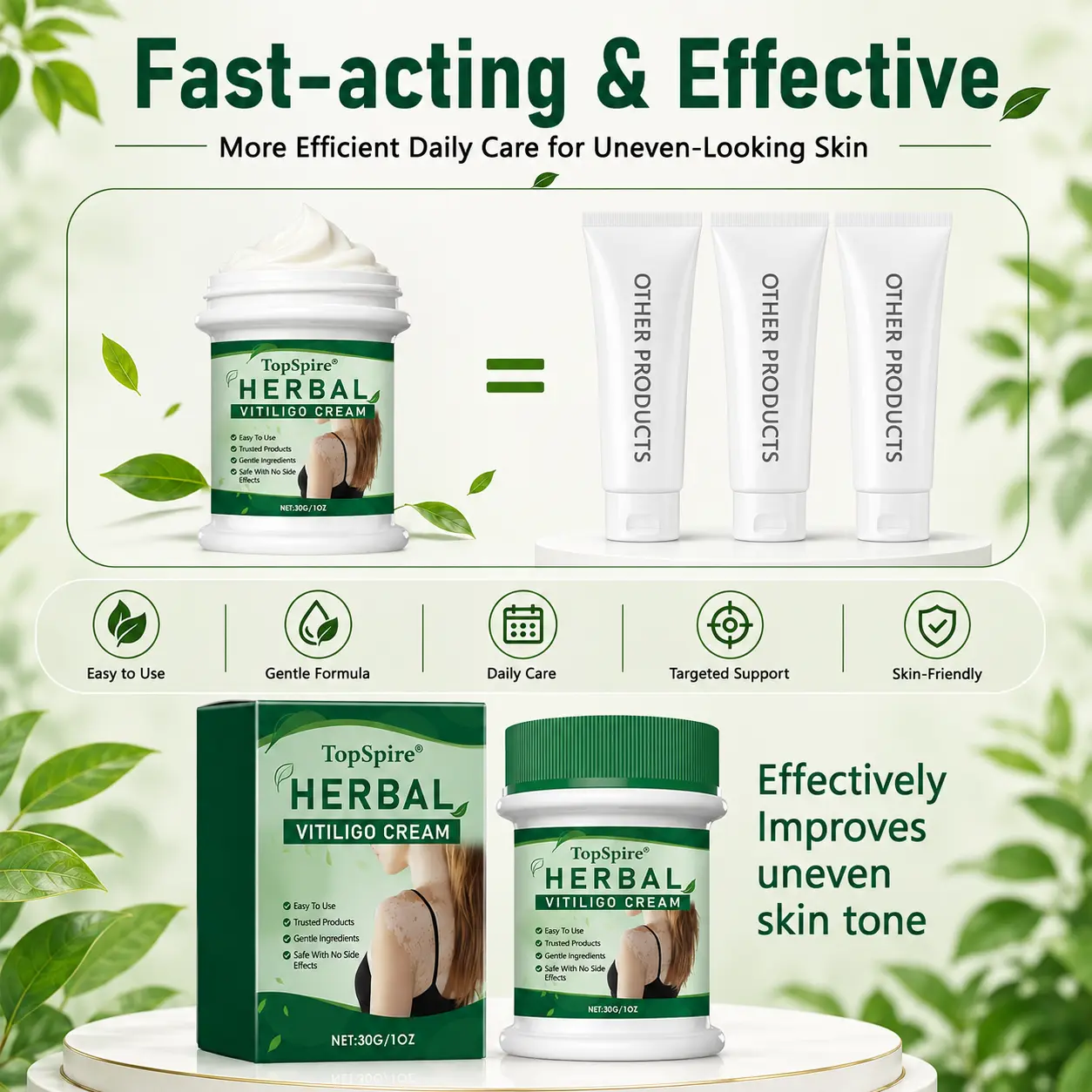 TopSpire® Herbal Vitiligo Cream