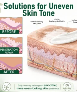 TopSpire® Herbal Vitiligo Cream