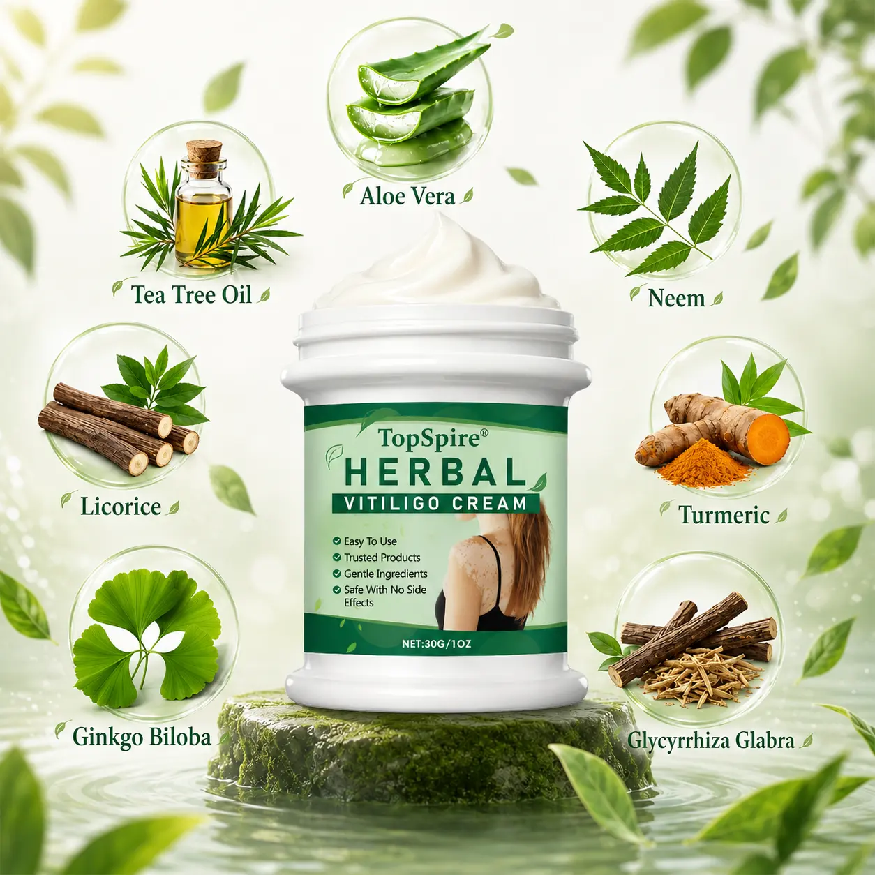 TopSpire® Herbal Vitiligo Cream